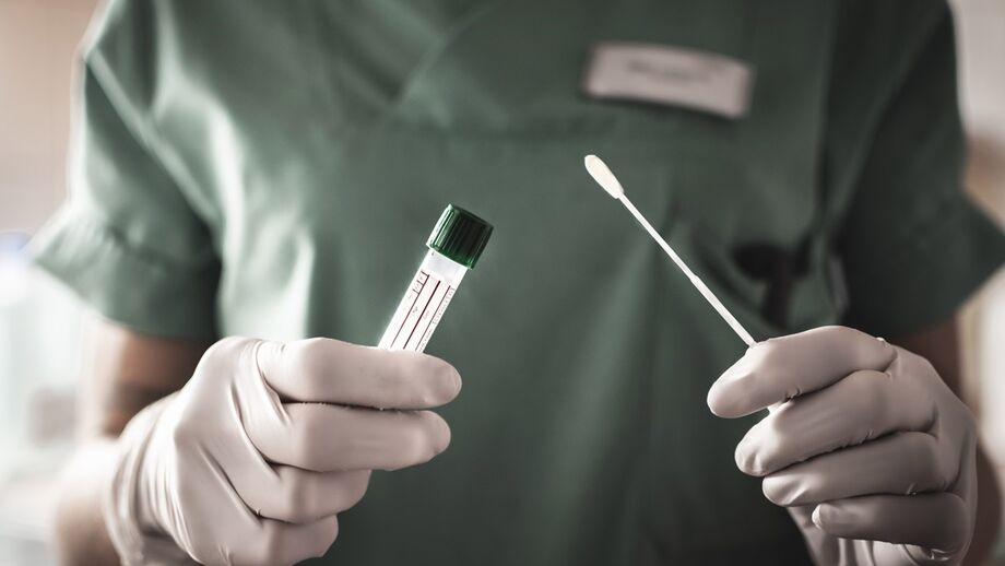 covid, testes, despistagem