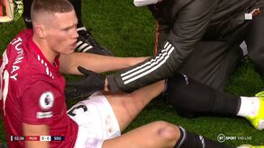 As marcas que Jankewitz deixou na perna de McTominay