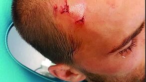 Ataque à Academia: Adepto que agrediu Bas Dost passa a ter de cumprir pena de prisão efetiva 
