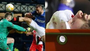 Esta imagem marcou a noite europeia: jogador do Rangers deu pontapé na cara do guarda-redes do Slavia