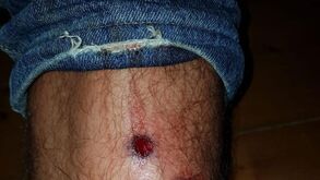 Adeptos do Sporting mostram marcas das balas de borracha