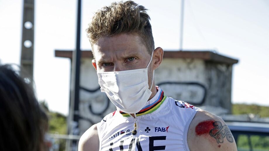 As marcas da queda que obrigou Rui Costa a desistir da Volta ao Algarve