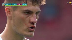 Além de suor houve (muito) sangue: Schick abriu o marcador no Croácia- Rep. Checa neste estado