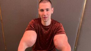 Lutador que injetou 6 litros de synthol nos braços e viu o bíceps romper corre risco de vida
