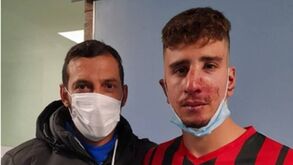 Gondim Maia pede desculpa pela agressão a jogador do AC Milheirós