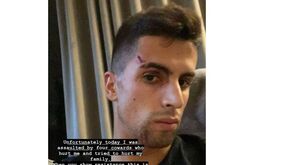 João Cancelo assaltado e agredido: «Não sei como há pessoas tão más...»