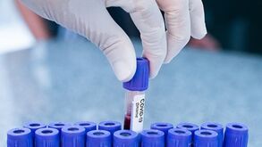 Covid-19: Portugal regista novo máximo diário e ultrapassa os 30 mil casos em 24 horas