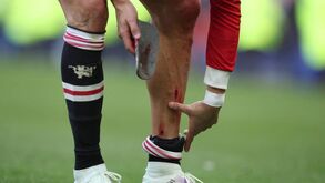 Assim ficou a perna esquerda de Ronaldo no final do jogo do Manchester United