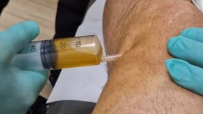 Imagens impressionantes: Ibrahimovic mostra como lhe retiraram líquido do joelho durante 6 meses