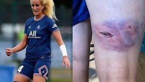 Jogadora do PSG recorda violentas agressões com barra de ferro: «Pensei que ficava ali»