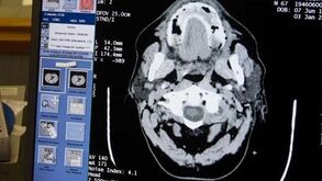 Cabeceamentos nos jogos sub-12 proibidos: Inglaterra testa regras para limitar riscos de doenças degenerativas no cérebro