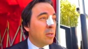 Presidente do Rayo com penso no nariz após 