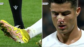 Pisadela no tornozelo e depois pancada no nariz: Cristiano Ronaldo a sangrar após estes lances