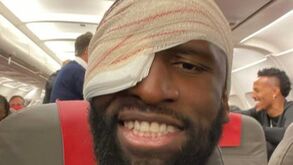 Rüdiger mostra 'marcas de guerra' após levar 20 pontos na cabeça: «Estamos vivos»