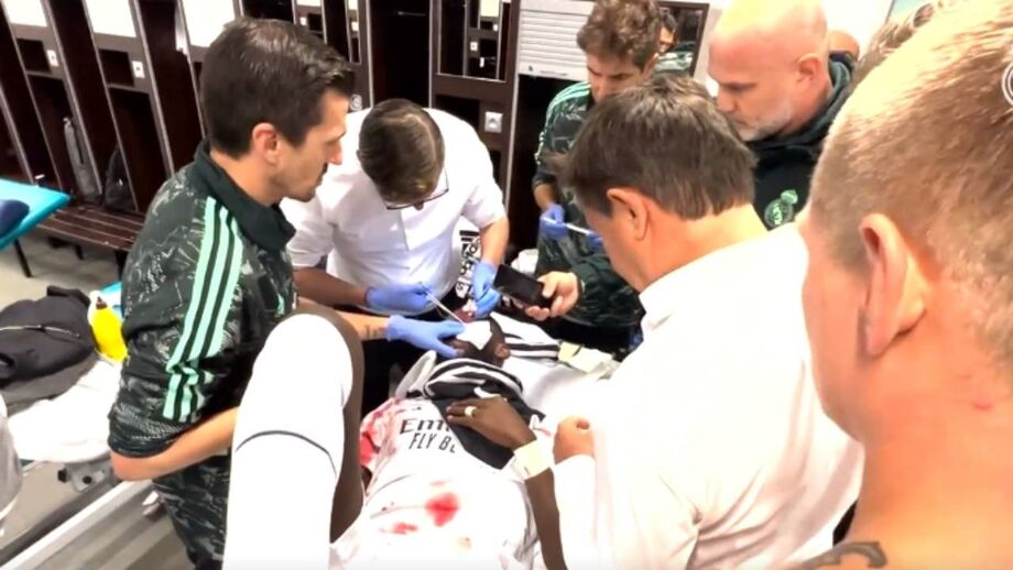 Central dos merengues chocou com o guarda-redes do Shakhtar