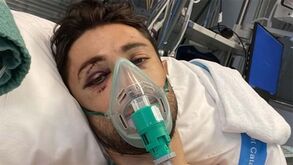 Dario Cataldo mostra consequências da grave queda que sofreu na Catalunha