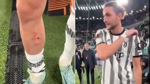 Rabiot mostra como ficou a sua perna após jogo com o Sevilha: «Falta clara, o VAR não disse nada...»