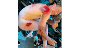 Ciclista da Astana sofreu queda, ficou neste estado... mas parece que não doeu
