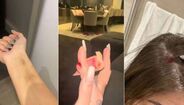O estado em que Gabriela Cavallin terá ficado depois das agressões