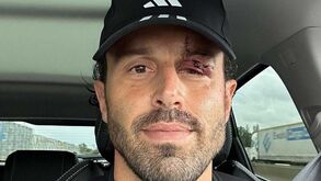 13 pontos e muito maltratado: revelada nova imagem do treinador do Lyon após ataque a autocarro