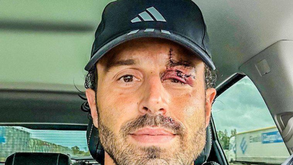 «Uma tragédia para o futebol»: Fabio Grosso reage ao ataque de que foi vítima antes do Marselha-Lyon