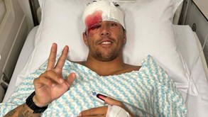 Vasco Ribeiro sofre acidente a surfar e é suturado com 50 pontos na cara: «Pensei que ia morrer afogado»