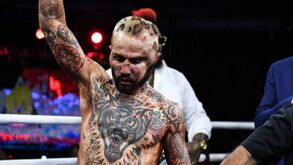 Imagens chocantes: lutador acaba com enorme hematoma na cabeça após luta de boxe sem luvas