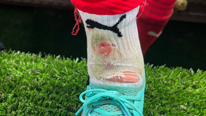 «Amarelo para o José Fonte...»: Diretor de comunicação do Sp. Braga mostra como ficou o central após lance com Musa