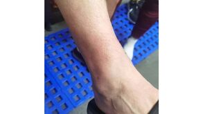 Olivais e Moscavide denuncia 