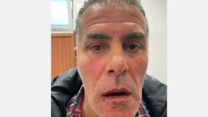 Treinador do Moncarapachense agredido no final do jogo com o Elvas