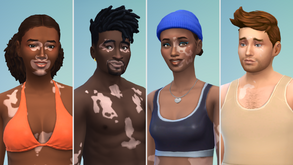 The Sims 4 introduz recurso de skin Vitiligo no jogo com Winnie Harlow