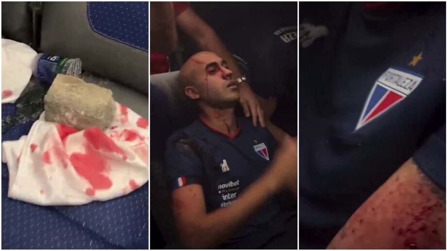 Vários elementos do plantel principal tiveram que ser transportados para o hospital para tratar dos ferimentos que, ao que tudo indica, foram causados por um grupo de adeptos do Sport