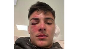 AF Porto: jogador do Varziela agredido por adversário durante o jogo com o Aparecida