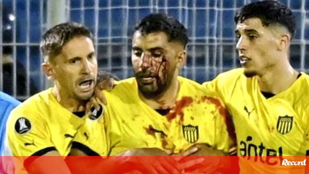 Inacreditável: jogador do Peñarol fica com o rosto ensanguentado após ser atingido por pedra... durante jogo da Libertadores