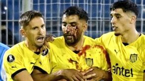 Inacreditável: jogador do Peñarol fica com o rosto ensanguentado após ser atingido por pedra... durante jogo da Libertadores