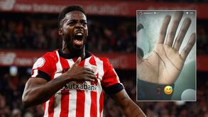 Incrível: Iñaki Williams jogou durante 2 anos com pedaço de vidro no pé
