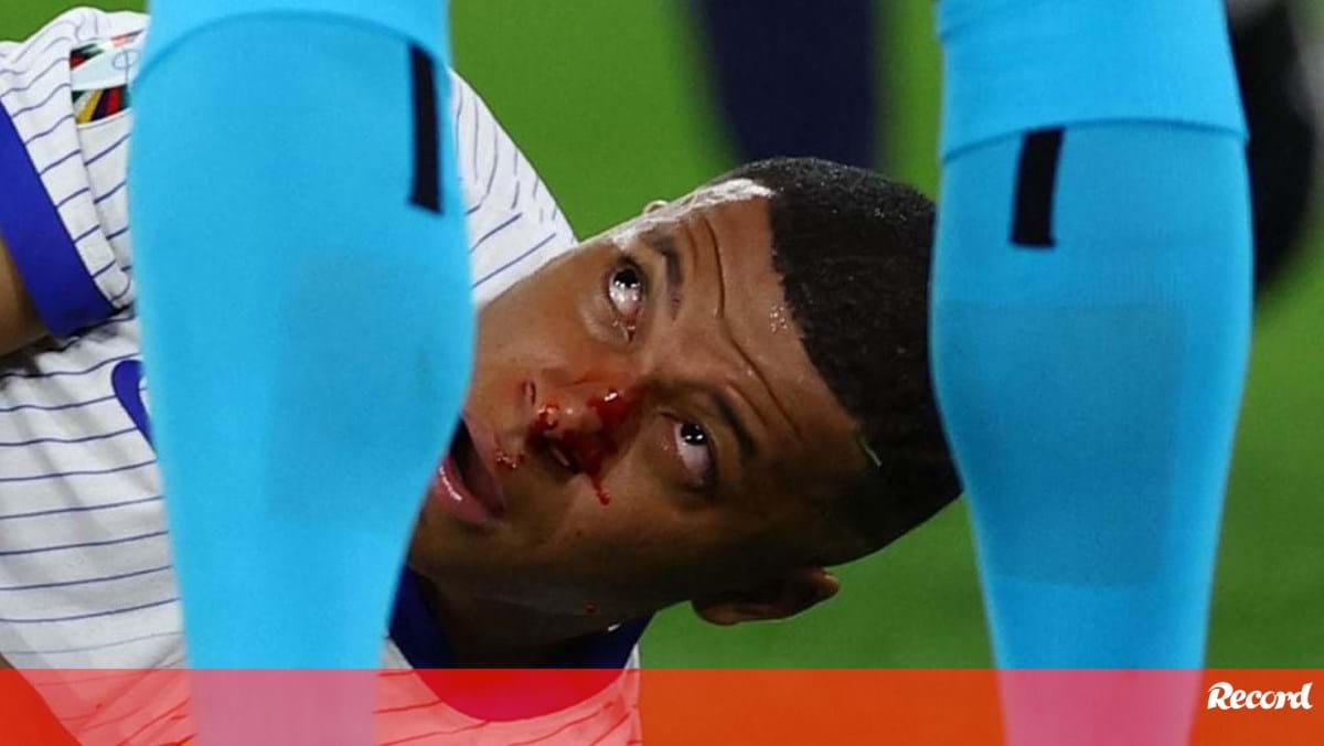 Arrepiante: Mbappé chocou com adversário e acabou com nariz neste estado