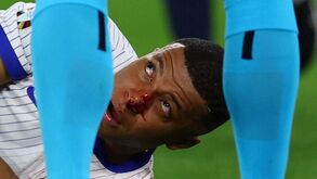 Boas notícias para a seleção francesa: Afinal Mbappé não precisará de ser operado