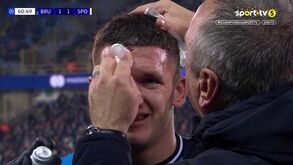Club Brugge-Sporting: mesmo com agrafo na testa, Tzolis teve de sair duas vezes na 2.ª parte por estar a sangrar