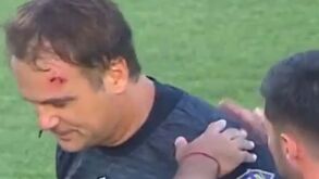 Jogo na Argentina suspenso após agressão a árbitro auxiliar: assim ficou a testa de Diego Martín