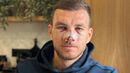 Edin Dzeko
