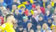 Edin Dzeko atingido na face