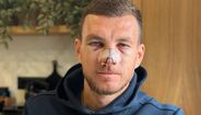 Edin Dzeko