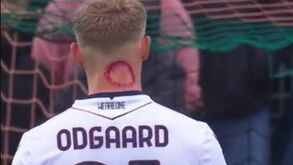 Não foi um zombie: Jens Odgaard já explicou lesão no pescoço