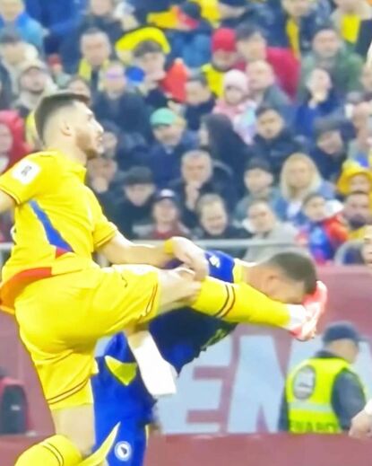 Edin Dzeko atingido na face