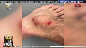 Benfica mostra como ficou o tornozelo de António Silva após lance na área do Farense