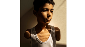Fotografia do ano da World Press Photo mostra menino palestiniano mutilado em Gaza