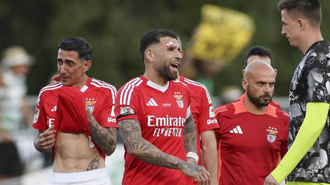 Otamendi terminou o jogo a sangrar