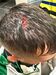 Adepto do Sporting mostra ferimentos na sequência de carga policial da festa do título