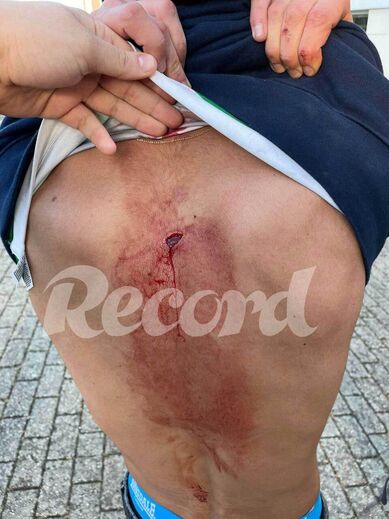 O estado em que ficou o jovem esfaqueado